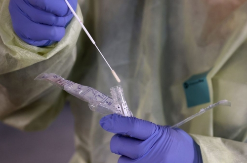 Rapid test &Zeta;&alpha;&gamma;&kappa;&lambda;&iota;&beta;έ&rho;&iota;