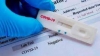 Rapid test &Lambda;&alpha;&gamma;&kappa;&alpha;&delta;ά&sigmaf;