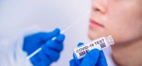 rapid test &Lambda;&alpha;&gamma;&kappa;&alpha;&delta;ά&sigmaf;