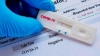 Rapid test &Lambda;&alpha;&gamma;&kappa;&alpha;&delta;ά&sigmaf;
