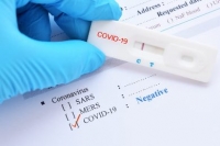Rapid test &Lambda;&alpha;&gamma;&kappa;&alpha;&delta;ά&sigmaf;
