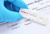 Rapid test  &Lambda;&alpha;&gamma;&kappa;&alpha;&delta;ά&sigmaf;